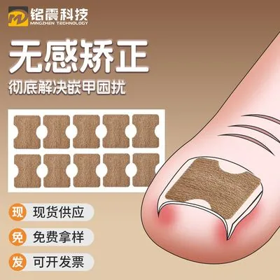 Ingrown Toenail Correction Patch (Glue-Free)